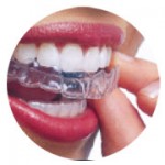 contenidos-tecnicas-ortodoncias-invisible