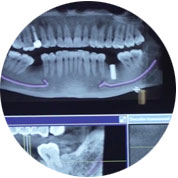 consulta ortodoncia invisible madrid